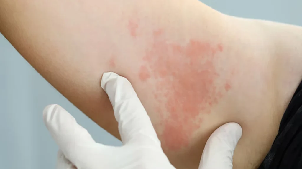 10 Common Skin Conditions