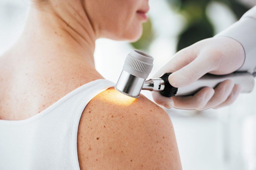 Skin Cancer Detection