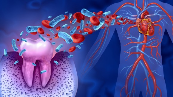 The Connection Between Periodontics and Systemic Health Issues Periodontics and Systemic Health Issues
