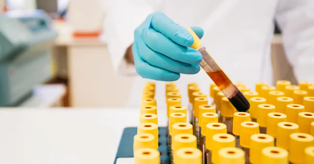 The Various Types of Lab Tests You Might Need Various Types of Lab Tests