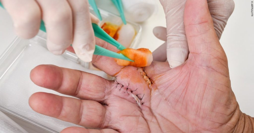 Wound Care Management