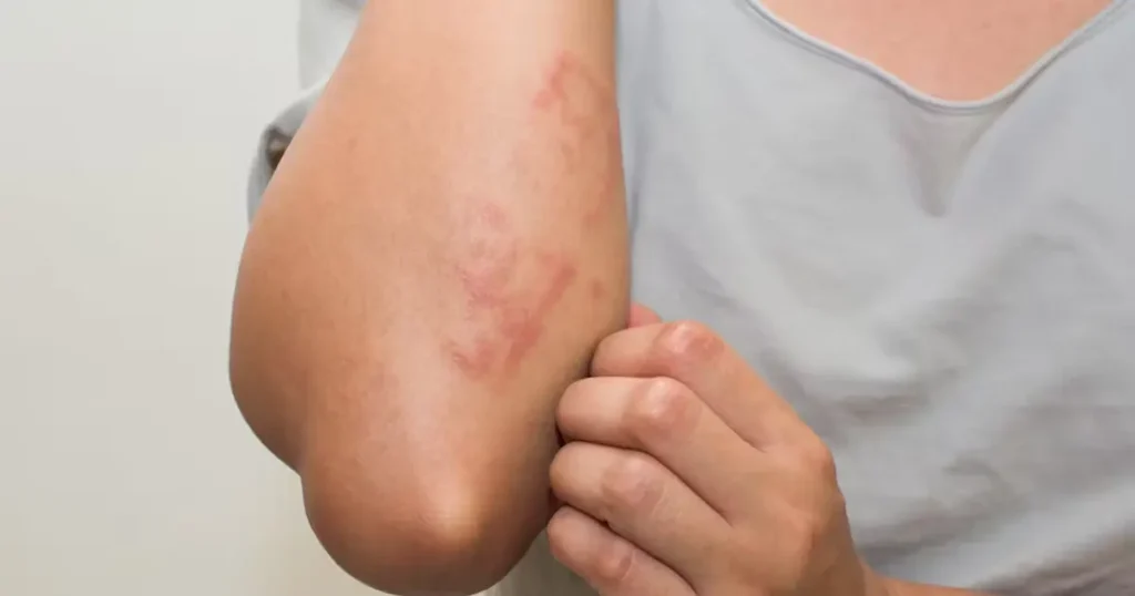 Common Skin Conditions That a Dermatologist Will Treat Common Skin Conditions