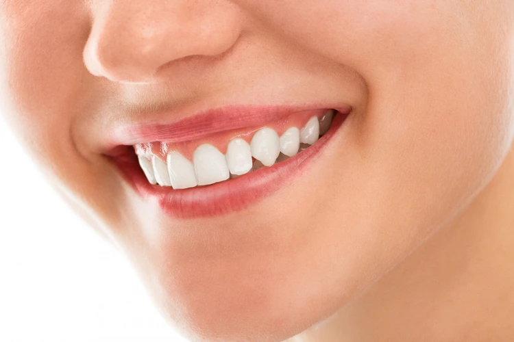 The Benefits of Seeing a Cosmetic Dentist for Teeth Whitening Teeth Whitening