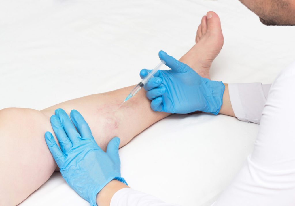 Vein Clinic